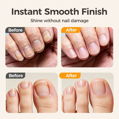 A🔥Last Day 50% OFF -✂️ 2-in-1 Smart Electric Nail Clipper & Polisher – Anti-Pinch Safety & LED Light 💅